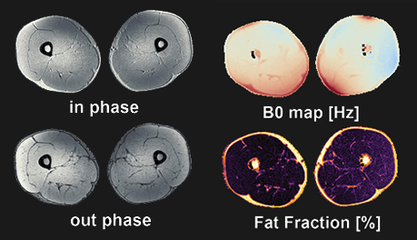 Dixon reconstruction output